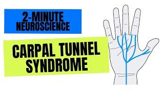 2-Minute Neuroscience: Carpal Tunnel Syndrome