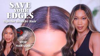 SAVE YOUR EDGES! STOP DOING THIS WITH YOUR LACE WIGS! Tips for HEALTHY HAIR 