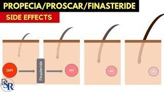  Propecia/Proscar (finasteride) Side Effects - The Secret To Fixing Them - By Dr Sam Robbins