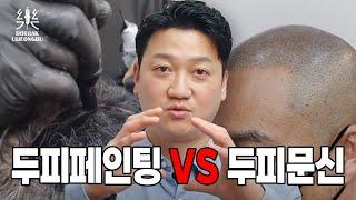 [도트락 의정부]두피페인팅 vs 두피문신 탈모인들의 선택은?