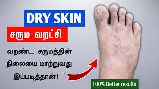 உண்மையிலேயே ஆச்சரியம் அளிக்கும் வறண்ட சரும எண்ணெய் | Dry Skin Tips | Dermatitis | Next Day 360