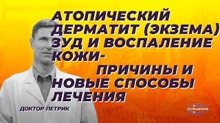 Атопический дерматит (экзема), зуд и воспаление кожи- причины и новые способы лечения.