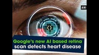 Google’s new AI based retina scan detects heart disease -  ANI News