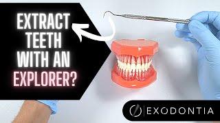 USING A DENTAL EXPLORER TO ASSIST WITH EXTRACTIONS | OnlineExodontia.com