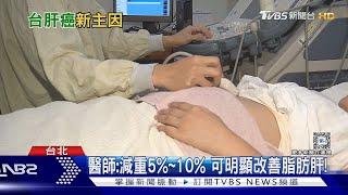 偏愛吃「這類型」食物...致過胖... 肝變成「這慘狀」....罹癌機率高!｜十點不一樣20240530@TVBSNEWS01