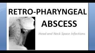 ENT Retropharyngeal Abscess Space Infection Node Rouviere Incision Drainage without anesthesia