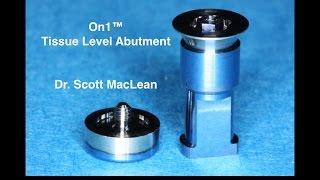 On1™ Base Abutment - Surgical Placement - Scott MacLean