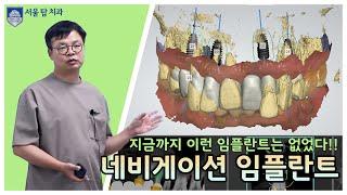 Part 2. 임플란트의 역사가 바뀌는 순간  "네비게이션 임플란트"