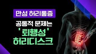 100세 시대, 허리가 관건! 만성 허리통증 환자들의 공통적인 문제는 바로 '퇴행성 허리디스크' [ 메디컬다큐365 ] 20240617