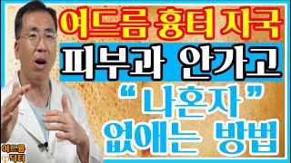 여드름 흉터 자국! 피부과 안가고 나혼자 없애는 방법 아크네마인드 원장 여드름 닥터가 알려드립니다 #여드름흉터 #여드름흉터없애는방법 #여드름흉터없애는법