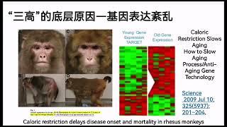 基因科学家王敬强博士讲为何三高总是相伴而生？