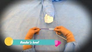 Laparoscopic Roeder's Knot