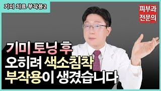 기미 치료 후 색소침착이 생겼다구요?ㅣ 기미 치료 부작용 2️⃣편