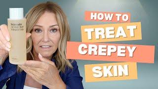 How to Treat Crepey Skin: Best Solution for Mature Women