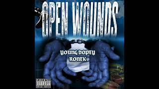 Young Dopey & Ronek - OPEN WOUNDS (Official Audio)