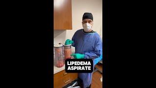 Breaking Down Lipedema: Dr. Wright Explores the Science of Lipedema Fat