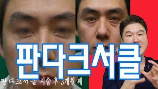 [CN SUB]다크서클 필러로 교정? 수술로 교정? 당신은 어떻게 교정 해야하는지 동영상을 통해서 확인 해 주세요