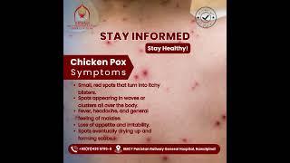 Chicken Pox Symptoms