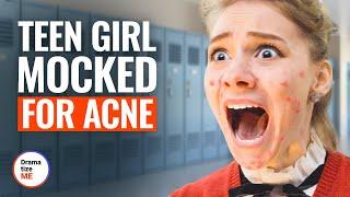 TEEN GIRL MOCKED FOR ACNE | @DramatizeMe