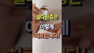 골다공증 치료는 이렇게 합니다! l 골다공증의 치료방법을 알아보자! #shorts [강북연세TV]