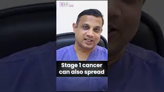 The Stages of Colon Cancer: Progression & Early Treatment? | SSO Hospital