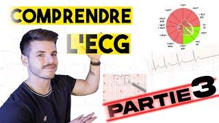 Lecture d'un ECG : la méthodologie complète (partie 3)