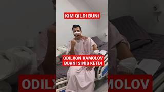 ODILXON KAMOLOV SINGAN BURNINI OPERATSIYA QILDIRDI