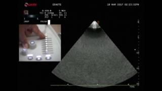 Basic M  Mode, 2D & Doppler Measuremants, Dr Rakesh Gupta