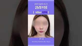 #shorts 실리프팅 효과 살펴보기! 피부 처짐 문제는 이것으로 해결!
