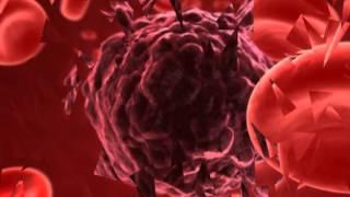 HIJAMA FOR THE TREATMENT OF BLOOD- CLOT (6)