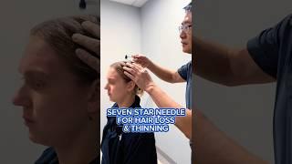 SEVEN STAR NEEDLE FOR HAIR LOSS & THINNING ⭐