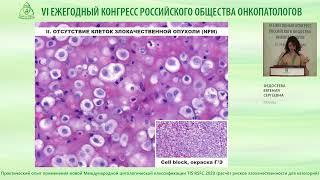 Практический опыт применения Международной классификации цитопатологии выпотных жидкостей TIS RSFC