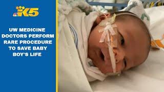 UW Medicine performs life-saving surgery on baby boy with rare birth defect