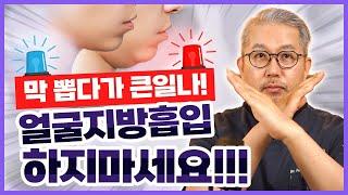 얼굴지방흡입 부작용:얼굴지방흡입 하기전에 꼭보세요!중요 얼굴지방흡입 부작용에 대해 꼭 알고 하세요.