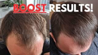 Increase Finasteride Hair Growth By +175% - Must Try!