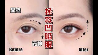 Eye Makeup Tips: Fixing Droopy, Sunken, Bulging Eyes!  不动刀解决眼部凹陷、外凸、下垂问题