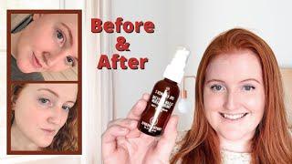 Youth to the People Vitamin C + Caffeine Serum | Honest Review + Before & After Pics