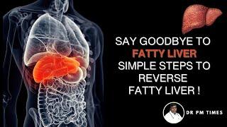 How to Reverse Fatty Liver Naturally: Essential Tips for Obese People - Dr. Murugesan Explains.