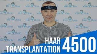 Haartransplantation Istanbul  - Erfahrung Türkei 4500 Grafts