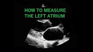 ECHOCARDIOGRAM: How to measure the Left Atrium (Diameter)!