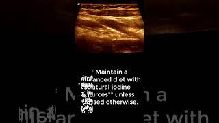 **Benign Thyroid Adenoma on Ultrasound: What to Know, Do, and Avoid**