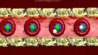 Intrauterine Growth Restriction (IUGR) Animation by Cal Shipley, M.D.