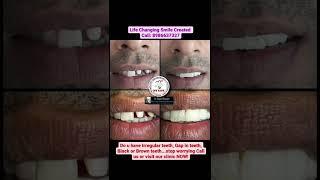 #omkaranandadental #drsouravbanerjee  #jamshedpurdental #dentalhub #dental  #bestdentist #topdentist