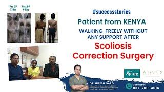 Sharing my Happy experience after COMPLEX Scoliosis Correction Surgery in India #kenya #scoliosis
