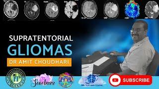 DR Amit Choudhari  -SUPRATENTORIAL GLIOMAS #glioblastoma #oligodendroglioma #astrocytoma