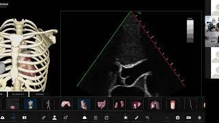 Imaging the difficult to scan ICU patient with TTE
