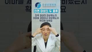 안면마비가 왔을 때 이마에 주름이 접히는지 꼭 확인하세요