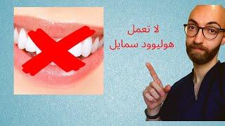 Hollywood smile   -٦ امور مهمة  لازم تعرفها قبل ما تعمل هوليوود سمايل