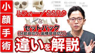 ルフォー／SSROとセットバック（分節骨切り、歯槽骨骨切り）の違い