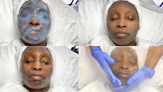 Microdermabrasion On Dry to Glowy Skin | GlamByLiaLeigh